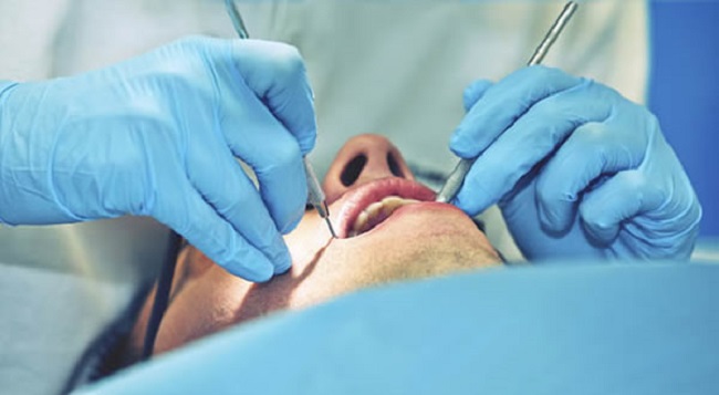 mengenal profesi dokter spesialis bedah mulut